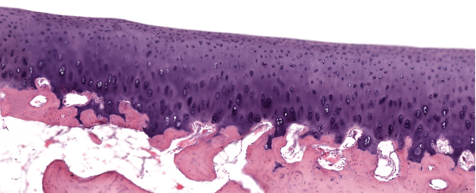 <p><strong>Cartílago de articulación (articulación)</strong></p>