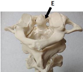 <p>For each joint determine the structural classification, subtype, and functional classification</p><p><strong>E. atlas and axis</strong></p>