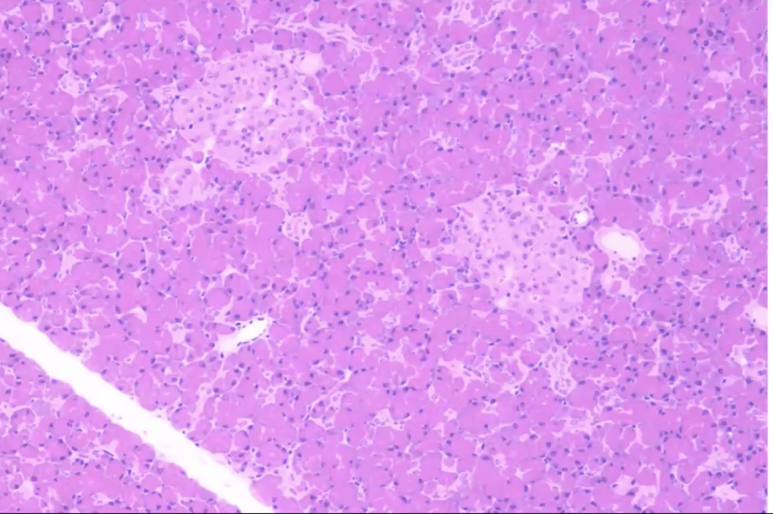 <p>What organ is this? Identify the acini and islets</p>