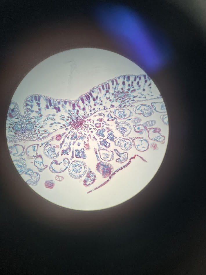 <ol><li><p>what is the phylum?</p></li><li><p>what is the structure?</p></li><li><p>what are the spherical structures in the bottom half? </p></li></ol><p></p>