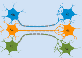 <p>Nerve damage without severing the Schwann cells (ex: crushing)</p>