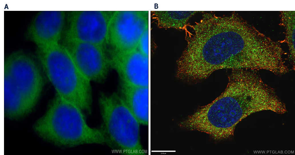 <p>what type of microscope used</p>