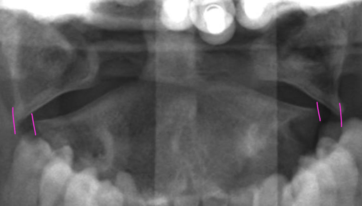 <p>What is the dx</p>