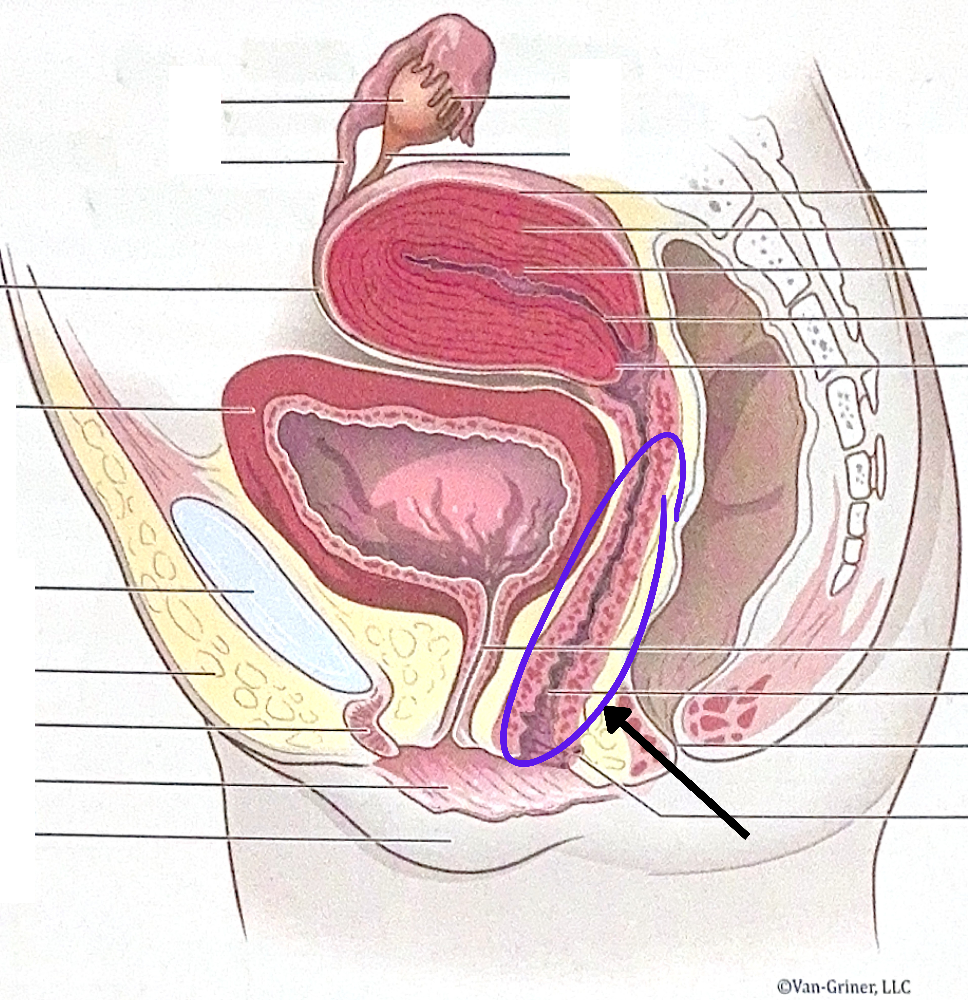 <p>What is the structure indicated in the image?</p>