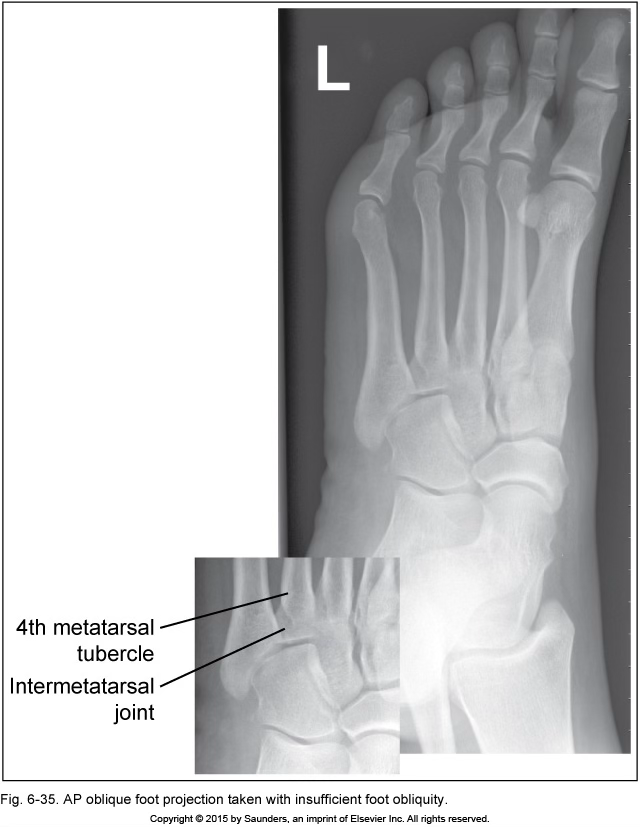 <p>AP oblique foot</p>
