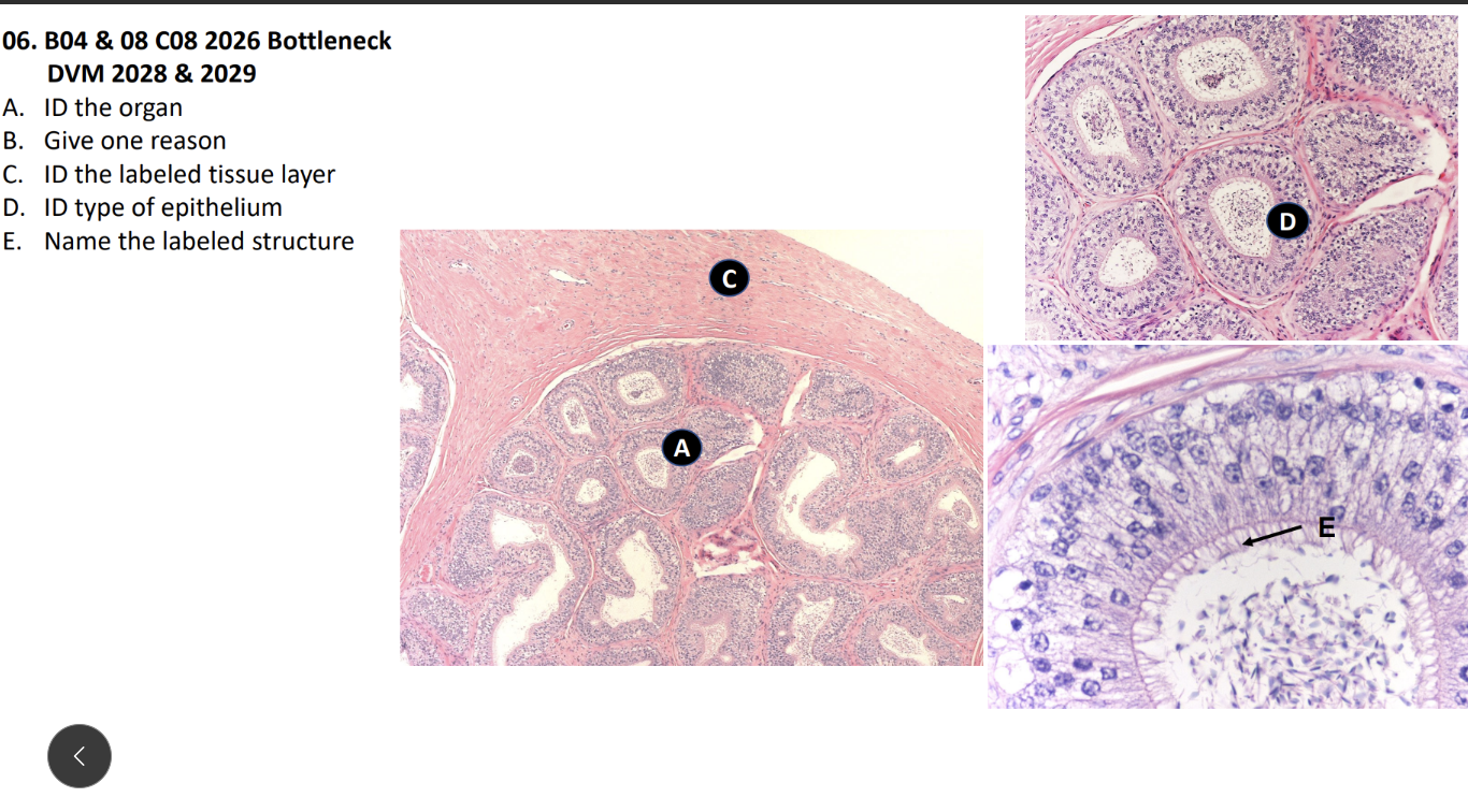 <p>A. ID the organ</p><p>B. Give one reason</p><p>C. ID the labeled tissue layer</p><p>D. ID type of epithelium</p><p>E. Name the labeled structure</p>