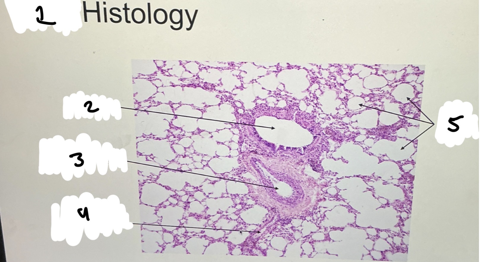 <p>XX HISTOLOGY</p><p>2.XX</p><p>3.XX</p><p>4.XX</p><p>5.XX</p>