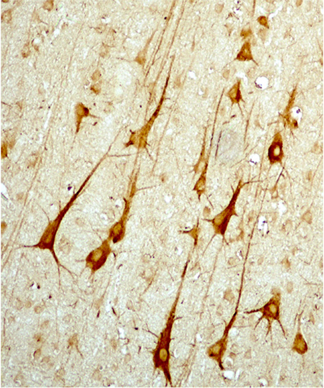 <p><span>Image: Pyramidal neurons in cerebral cortex. IHC was used to stain the ___________ (cytoskeleton).</span></p>