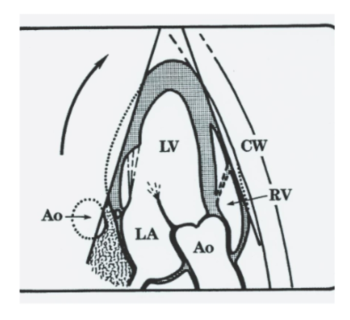 <p>Ap3ch Diagrams </p>