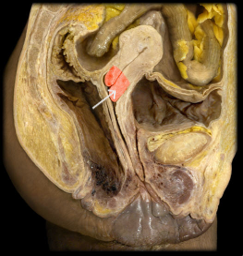 <p>what structure is highlighted? </p>