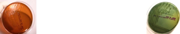 <p>This microorganism has <strong>no color </strong>on <strong>EMB plates </strong>making it a lactose non-fermenter, but it does appear <strong>blue-green </strong>on <strong>HE plates</strong>. Which microorganism is it? </p>