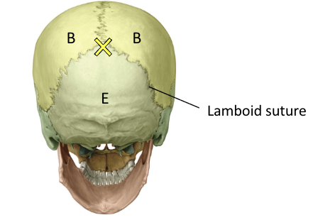 <p>Lambda (x area)</p>