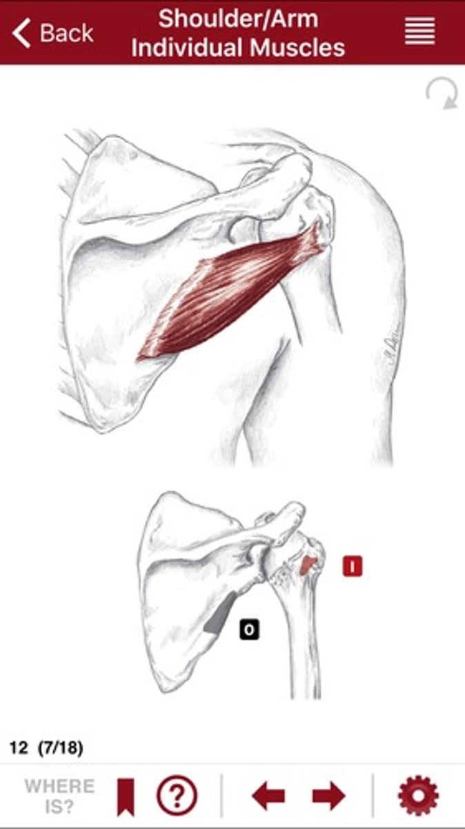 <p>What is this and what does it do? Give an origin and insertion.</p>