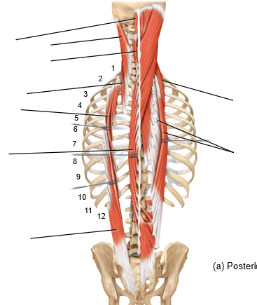 <p>What is the muscle in view? what is its action?</p>