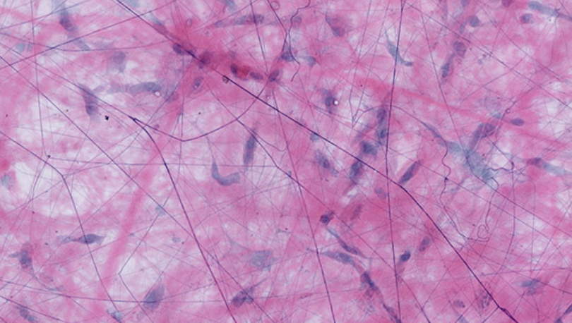 <p>has elastic (thin) fibers, collagen (thick) fibers, fibroblasts</p>