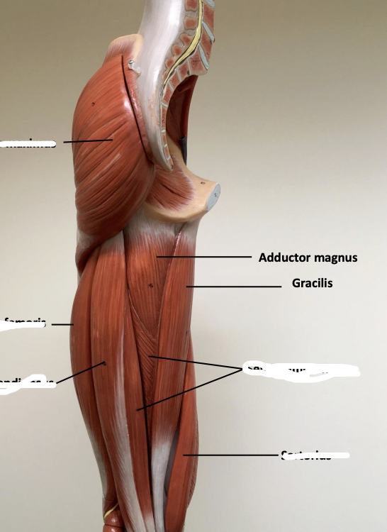 <p>Gracilis</p>