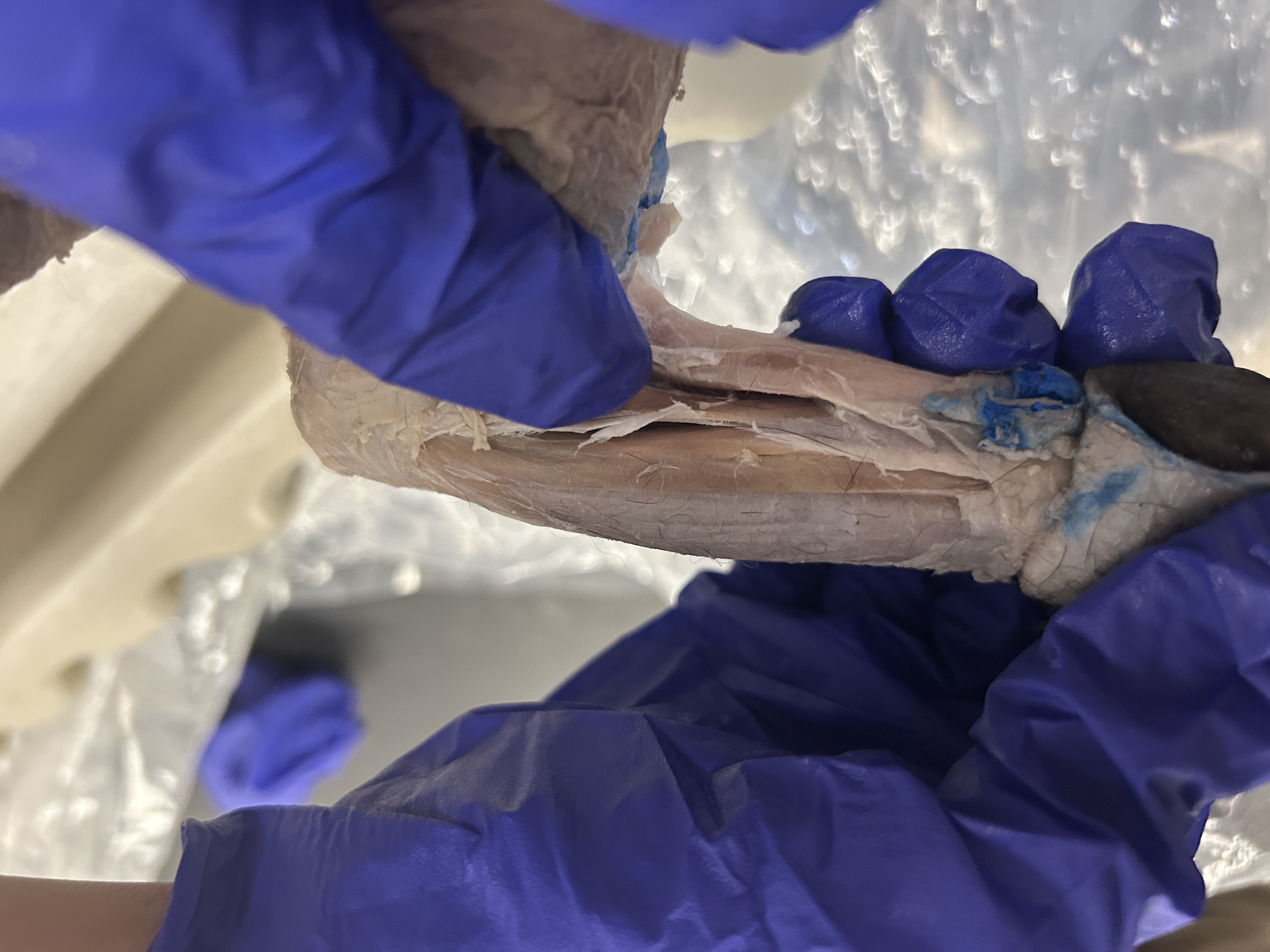 <p>Brachioradialis (under palmaris Longus) </p>