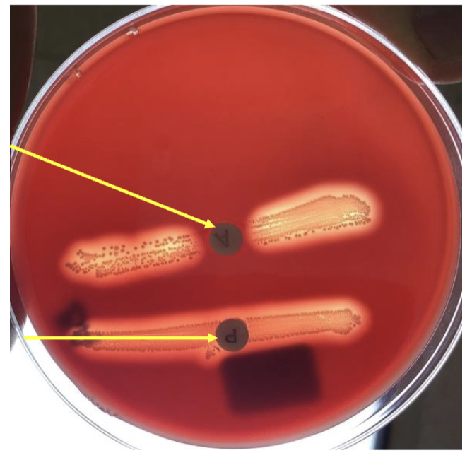 <p>what bacteria is this?</p>