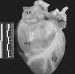 <p>what heart is this?</p>