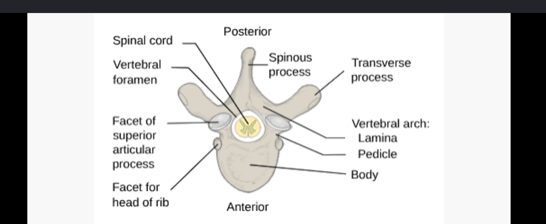 <p>Posterior protrusion </p>
