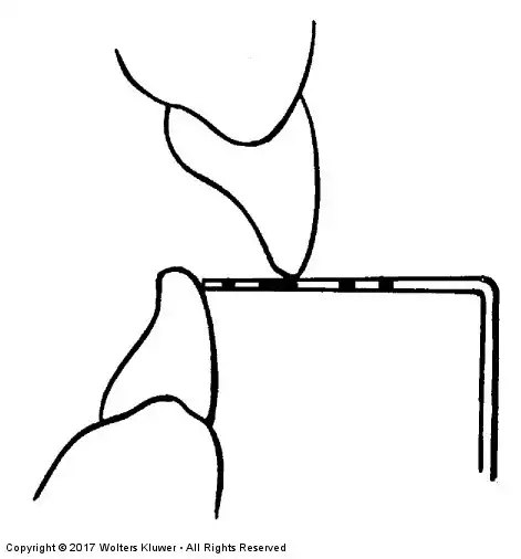 <p>What malrelation is the probe measuring?</p>