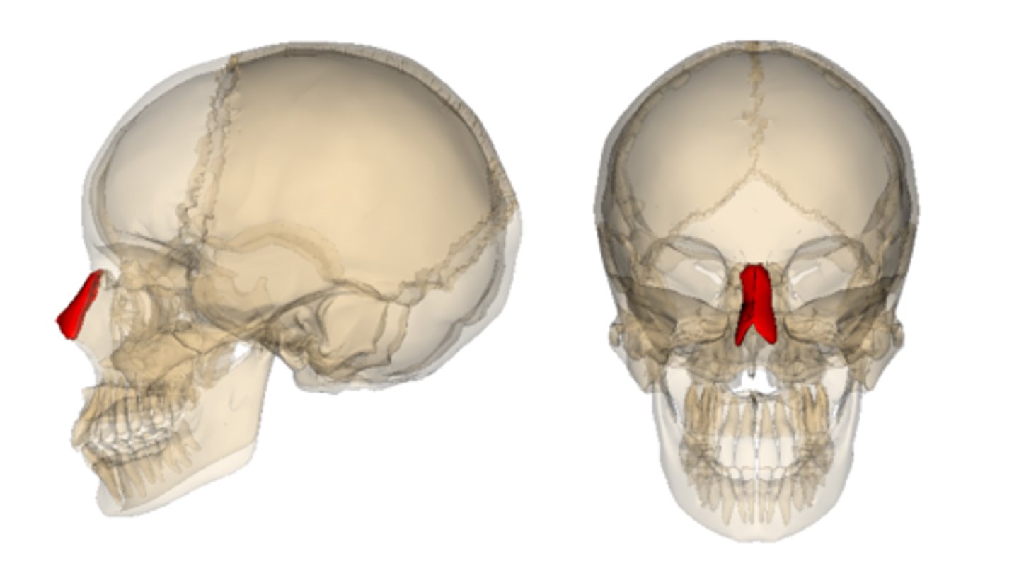 <p>ID bone highlighted in red</p>