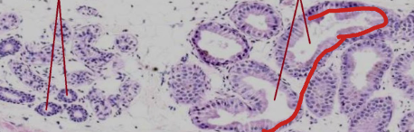 <p>Identify the gland type:</p>