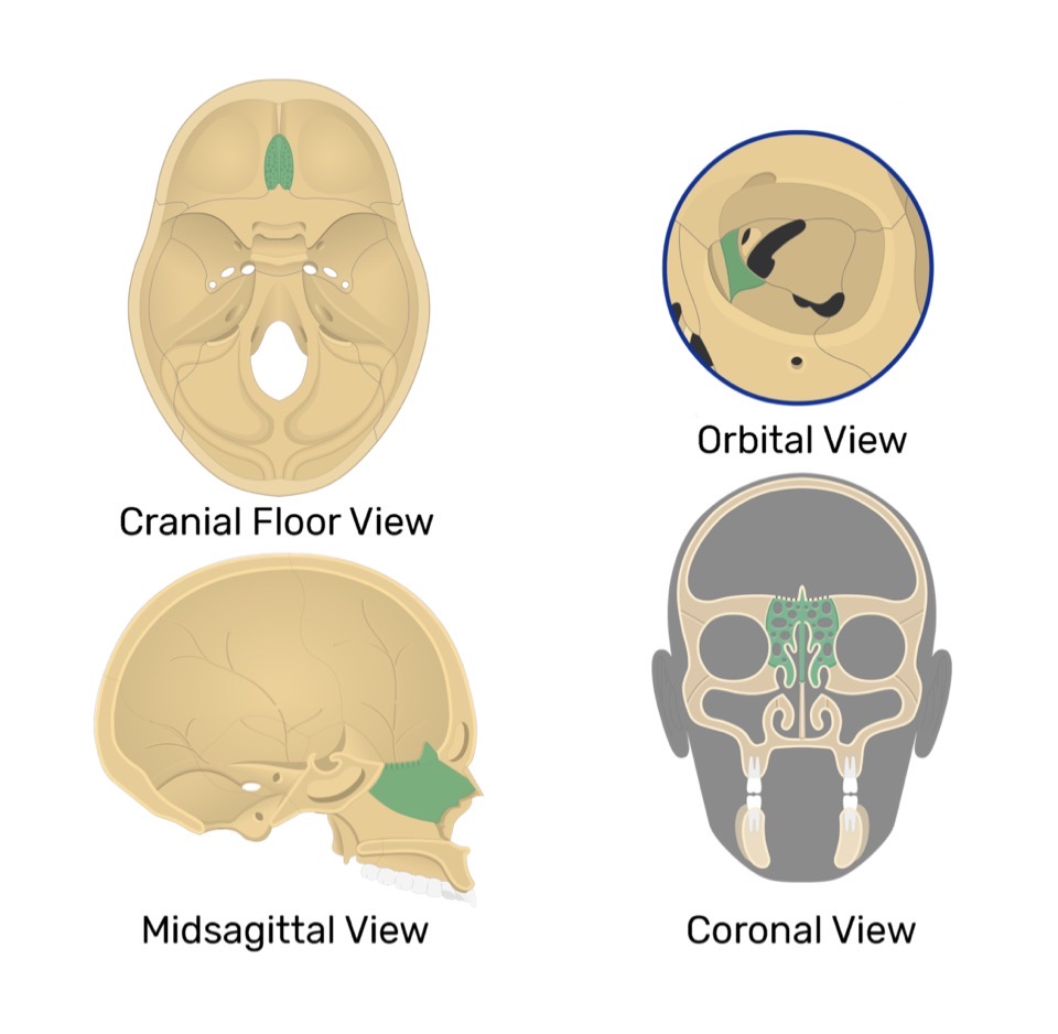 <p>Ethmoid bone</p>
