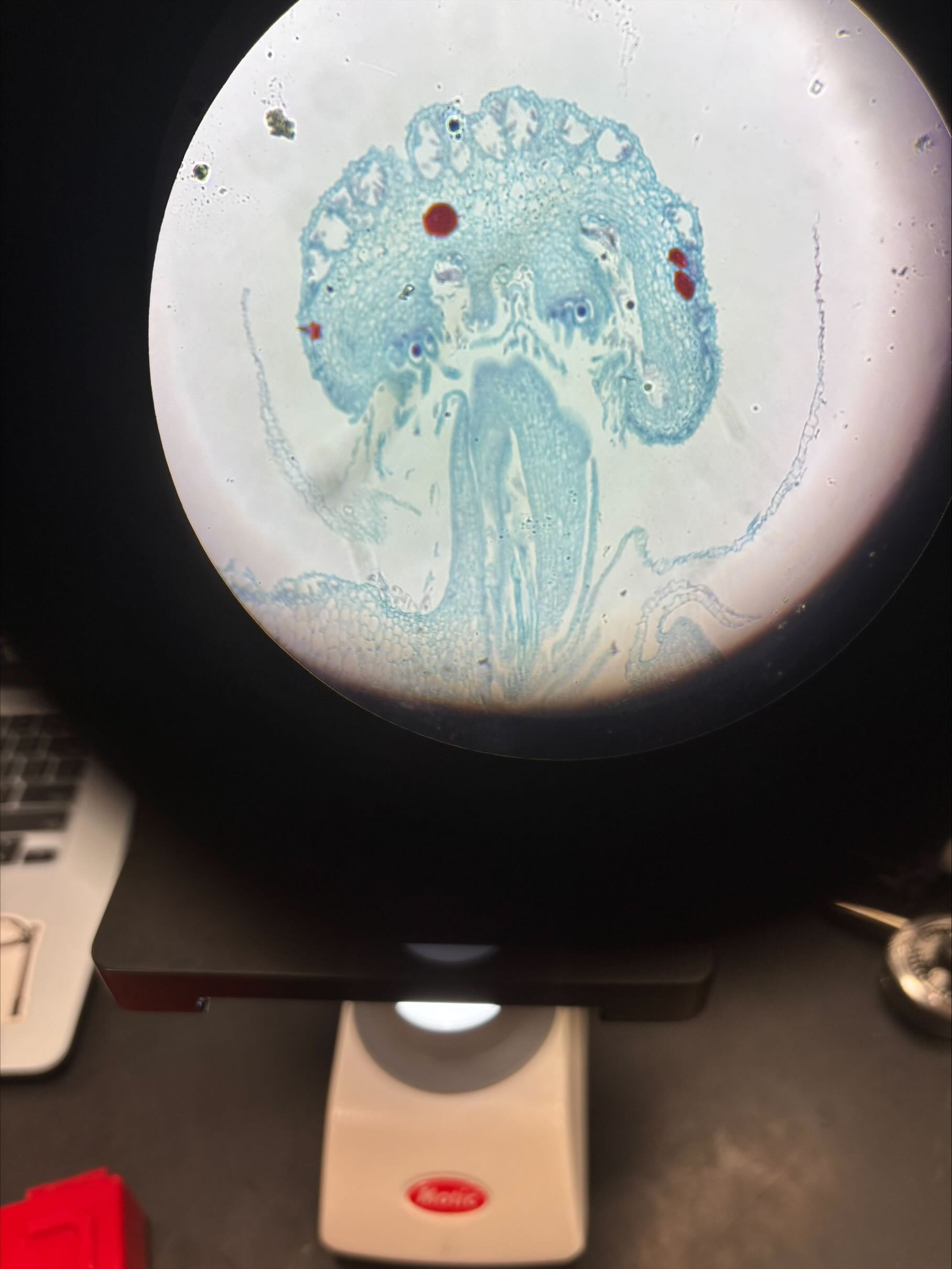 <p>archegoniophore or antheridiophore</p>