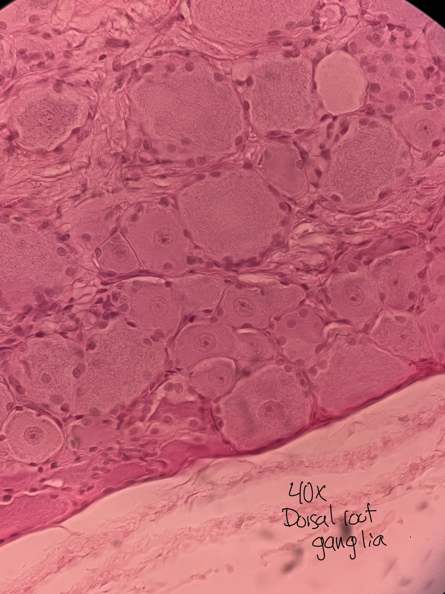 <p>The lighter staining of this image represents a tissue that is _____ and is stained by a _____ stain</p>