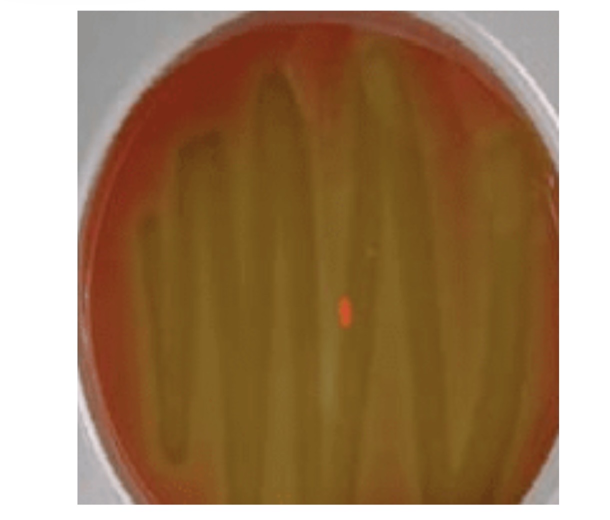 <p>A. What type of plate is shown here? </p><p>B. What type of hemolysis do you see on this plate? </p><p>C. What are all three types of Hemolysis called? </p>