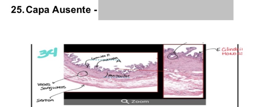 <p>submucosa </p>