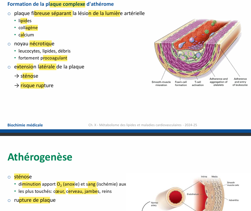 <p>rupture de plaque peut donner occlusion d’autres petit vaisseaux </p>