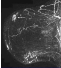 <p>What pathology? </p>