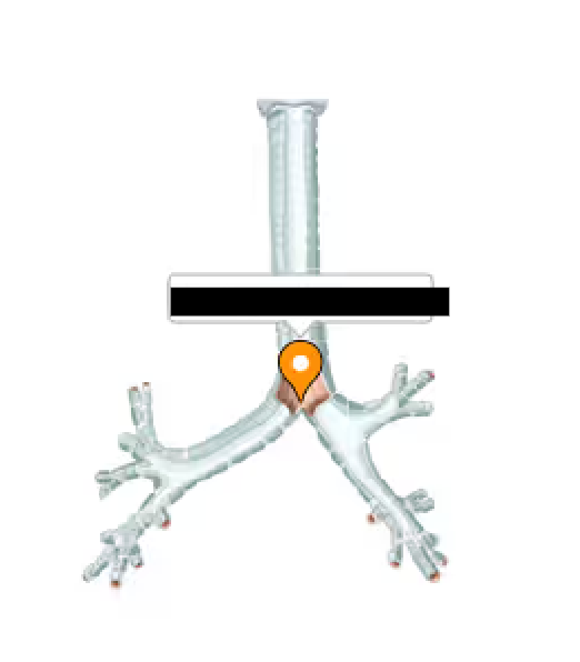 <p>Area where the inferior end of the trachea divides into right and left bronchi.</p>