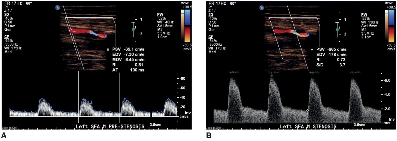<p>what does image B represent </p>