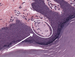 <p>Within the papillary layer of the dermis capable of detecting light touch and or tickles</p>