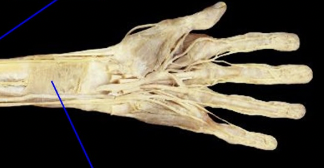 <p>what is the tagged area? Then state the origin, insertion, and main actions.</p>