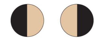 <p>Lesion at optic chiasm (<em>ex pituitary tumor</em>). Vision loss in temporal ½ each field</p>