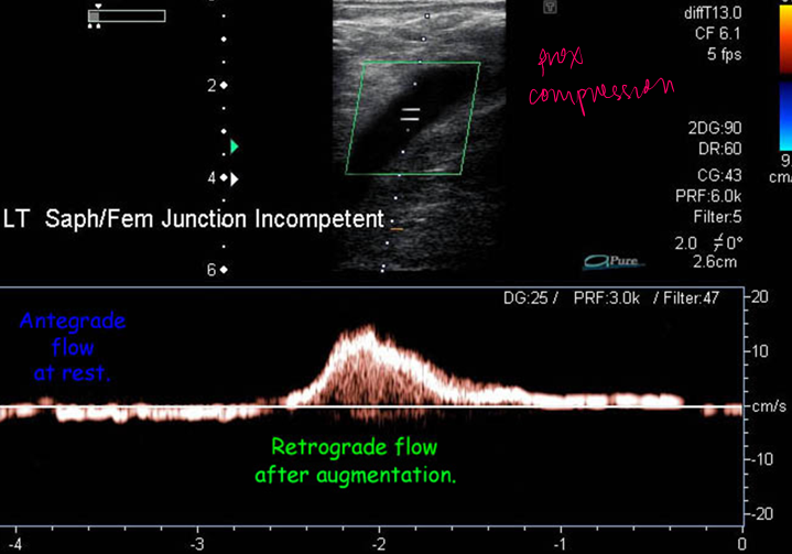 <p>is this normal or abnormal</p>