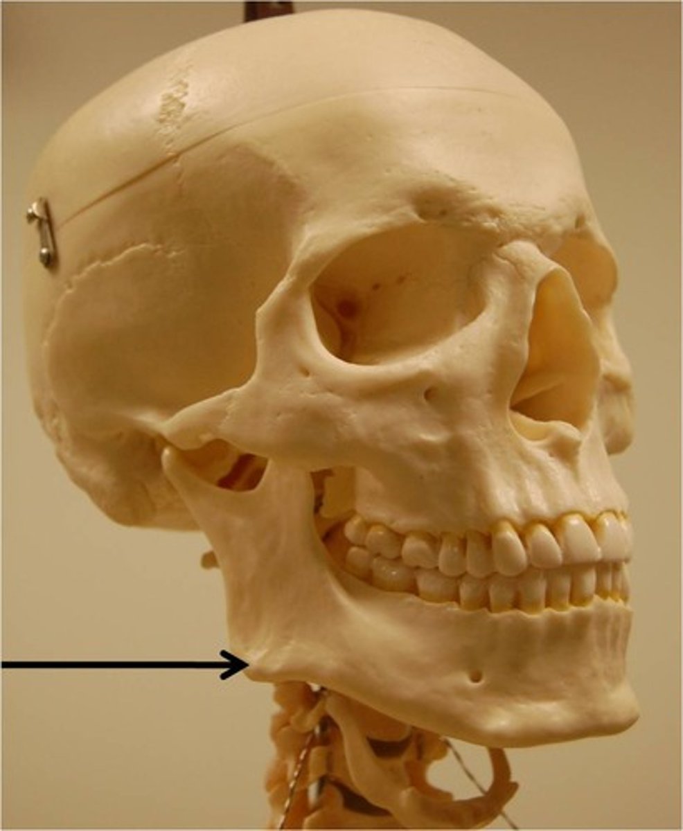 <p>ID bone at arrow</p>