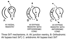 <p>conduction from the end of the axon to the soma (sensory neurons)</p>