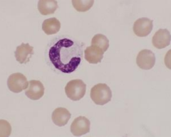 <p>immature neutrophil</p>
