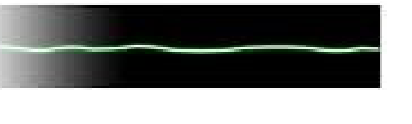 <p>Asystole</p><ul><li><p>describe</p></li><li><p>Pt characteristic (3)</p></li><li><p>must assess (1)</p></li><li><p>usually a result of (3)</p></li><li><p><strong>treatment: (4)</strong></p></li><li><p>prognosis (1)</p></li></ul><p></p>