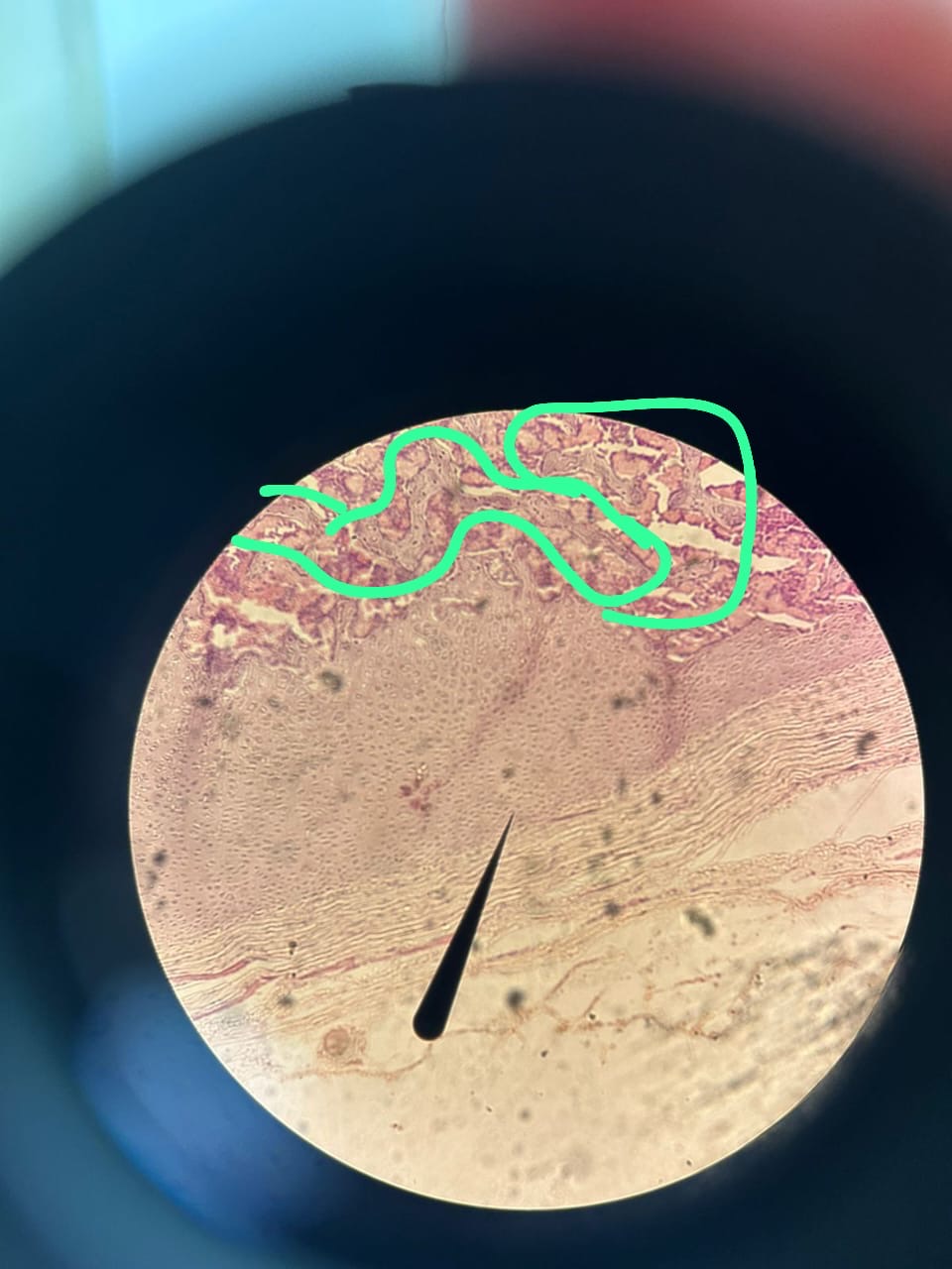 term image