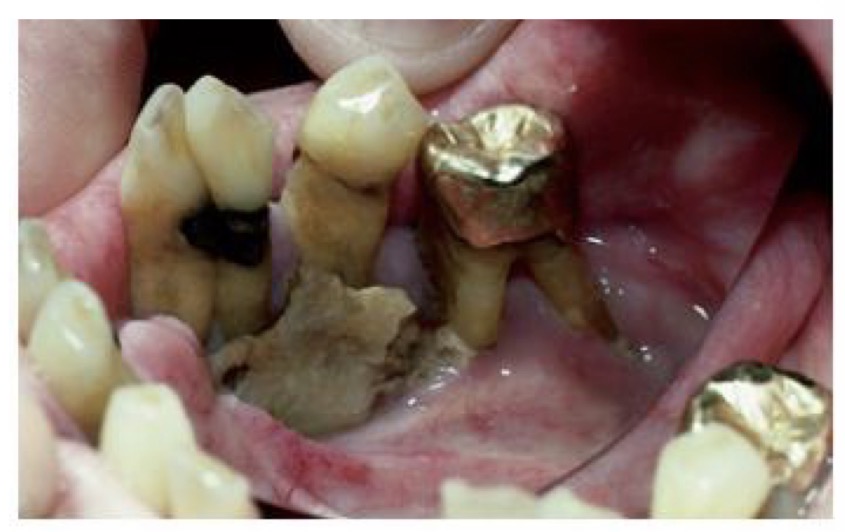 <p>CHẨN ĐOÁN?</p>