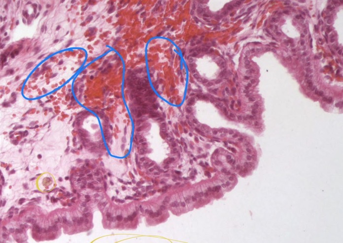 <p>What is circled in this image (blue)?</p>