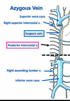 <p>Right = azygos; lower left = hemi; upper left = accessory hemi.</p>