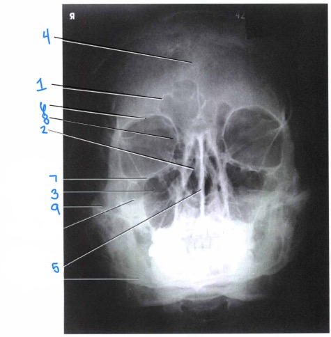 <p>7</p>
