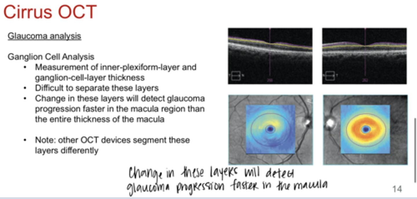 <p>What is the purpose of the ganglion cell analysis on Cirrus OCT?</p>